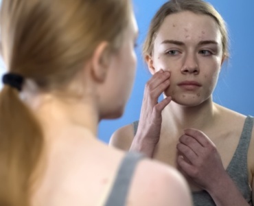 Przyczyny powstawania pryszczy - codzienna dbałość o równowagę skóry